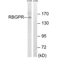 Rabbit Polyclonal Antibody to RAB3GAP2