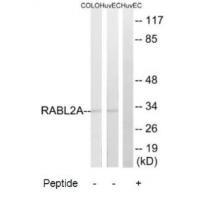 Rabbit Polyclonal Antibody to RABL2A