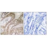 Rabbit Polyclonal Antibody to RDM1
