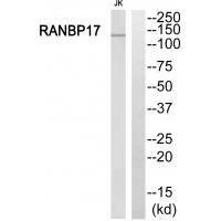 Rabbit Polyclonal Antibody to RANBP17