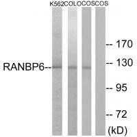 Rabbit Polyclonal Antibody to RANBP6