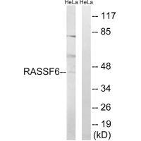 Rabbit Polyclonal Antibody to RASSF6