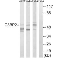 Rabbit Polyclonal Antibody to G3BP2
