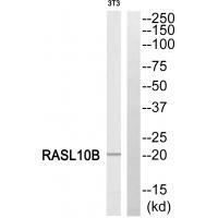Rabbit Polyclonal Antibody to RASL10B