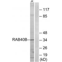 Rabbit Polyclonal Antibody to RAB40B