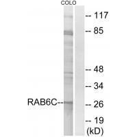 Rabbit Polyclonal Antibody to RAB6C