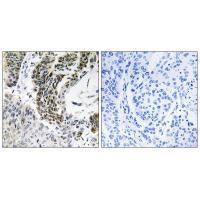 Rabbit Polyclonal Antibody to RREB1