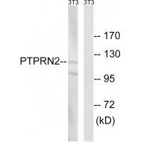 Rabbit Polyclonal Antibody to PTPRN2