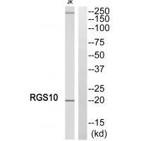 Rabbit Polyclonal Antibody to RGS1