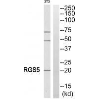 Rabbit Polyclonal Antibody to RGS5