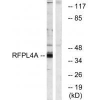 Rabbit Polyclonal Antibody to RFPL4A