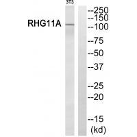 Rabbit Polyclonal Antibody to RHG11A