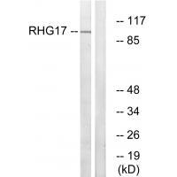 Rabbit Polyclonal Antibody to RHG17