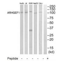 Rabbit Polyclonal Antibody to ARHGEF1