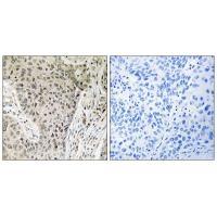 Rabbit Polyclonal Antibody to ARHGEF19