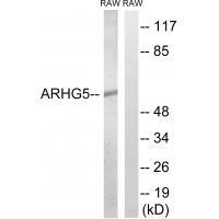 Rabbit Polyclonal Antibody to ARHGEF5