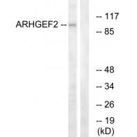 Rabbit Polyclonal Antibody to ARHGEF2