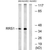 Rabbit Polyclonal Antibody to RRS1