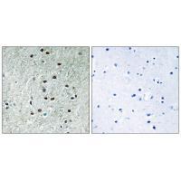 Rabbit Polyclonal Antibody to REXO1