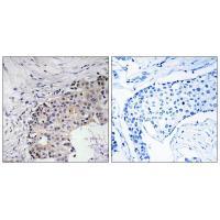 Rabbit Polyclonal Antibody to SCARF2