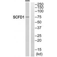 Rabbit Polyclonal Antibody to SCFD1