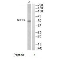 Rabbit Polyclonal Antibody to SEPT6