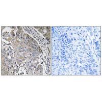 Rabbit Polyclonal Antibody to SPINK6