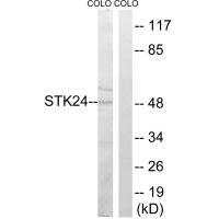 Rabbit Polyclonal Antibody to STK24