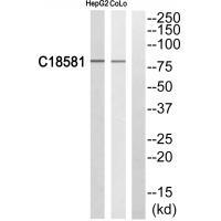 Rabbit Polyclonal Antibody to NEK5