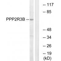 Rabbit Polyclonal Antibody to P2R3B