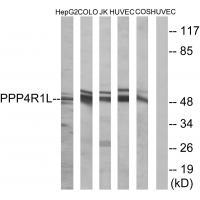 Rabbit Polyclonal Antibody to PPP4R1L