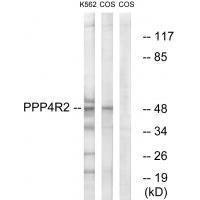 Rabbit Polyclonal Antibody to PP4R2