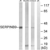 Rabbit Polyclonal Antibody to SERPINB9