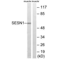 Rabbit Polyclonal Antibody to SESN1