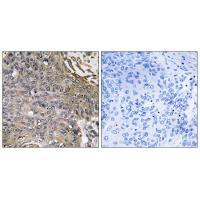 Rabbit Polyclonal Antibody to SH2D1B