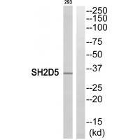 Rabbit Polyclonal Antibody to SH2D5
