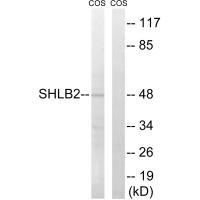 Rabbit Polyclonal Antibody to SH3GLB2