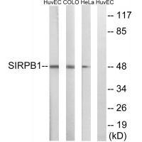 Rabbit Polyclonal Antibody to SIRPB1