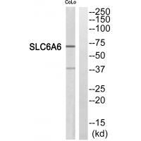 Rabbit Polyclonal Antibody to SC6A6