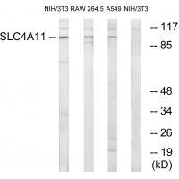 Rabbit Polyclonal Antibody to SLC4A11