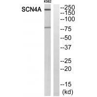 Rabbit Polyclonal Antibody to SCN4A