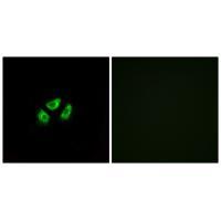 Rabbit Polyclonal Antibody to SCN7A