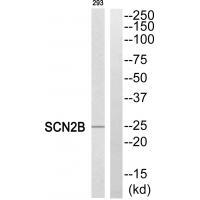 Rabbit Polyclonal Antibody to SCN2B