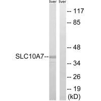 Rabbit Polyclonal Antibody to SLC10A7