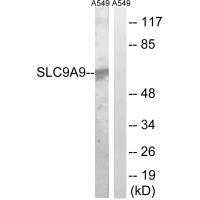Rabbit Polyclonal Antibody to SLC9A9