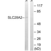Rabbit Polyclonal Antibody to SLC28A2