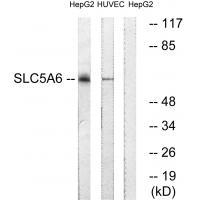 Rabbit Polyclonal Antibody to SLC5A6