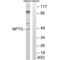 Rabbit Polyclonal Antibody to SLC17A2