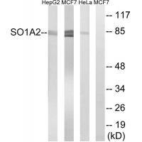 Rabbit Polyclonal Antibody to SLCO1A2