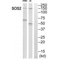 Rabbit Polyclonal Antibody to SOS2